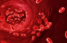 Kan Kanseri Belirtileri ve Tedavisi Kan Kanseri Belirtileri ve Tedavisi